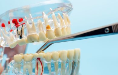 Bestsmile Migros ferme la start-up spécialisée dans le réalignement des dents