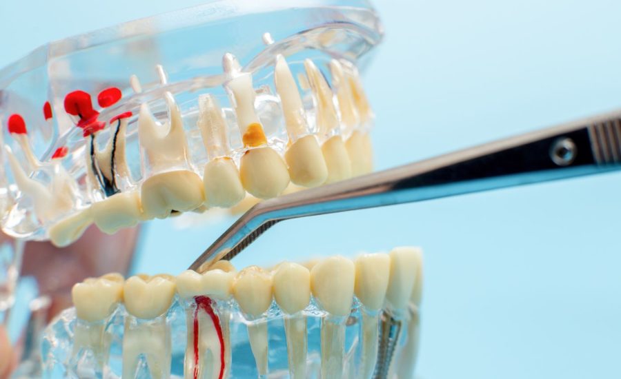 Bestsmile Migros ferme la start-up spécialisée dans le réalignement des dents